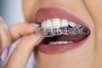 Clear Aligners in Memorial Houston- GB Dentistry