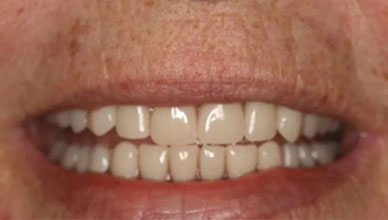 After Image - GB Dentistry