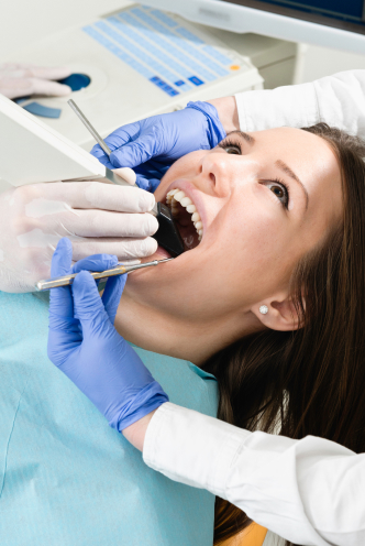 How Tooth-Colored Fillings Are Placed - GB Dentistry