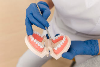 Revitalize Your Teeth with Dental Crowns - GB-Dentistry