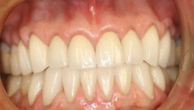 After Image - GB Dentistry