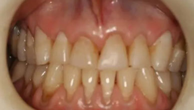 Before Image - GB Dentistry