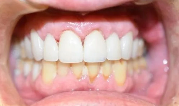 Smile Restoration 1 After - GB Dentistry