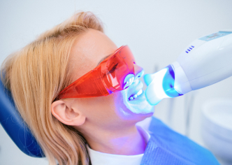 Teeth Whitening in Memorial Houston - GB Dentistry