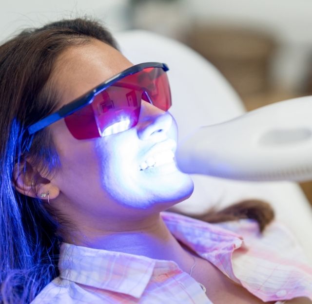 Teeth whitening specials in Memorial, Houston - GB Dentistry
