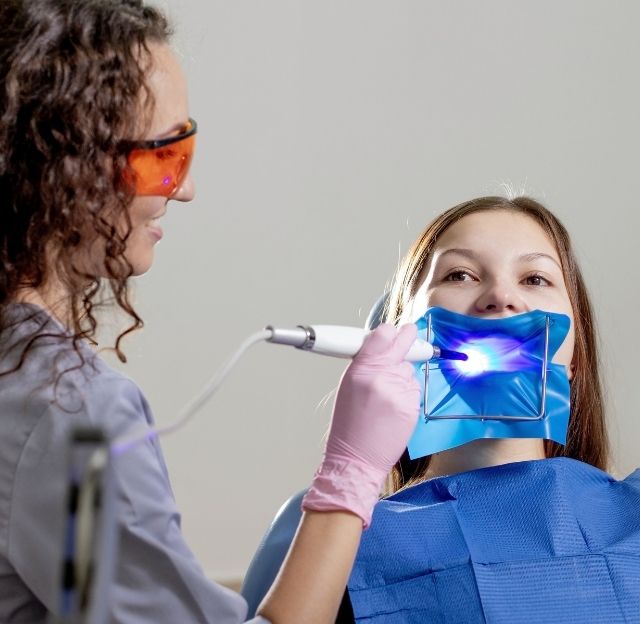 Tooth Colored Fillings in Memorial - GB Dentistry