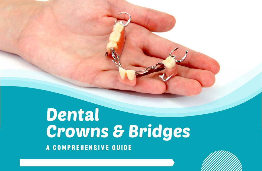 Dental Crowns & Bridges: A Comprehensive Guide