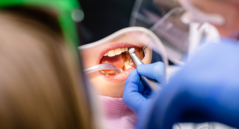 Preventive Dental Clinic in Memorial Houston, TX - GB Dentistry