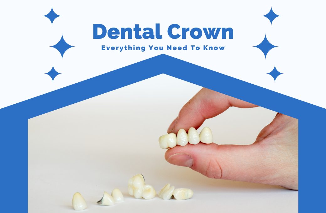 Dental Crown: Everything You Need To Know
