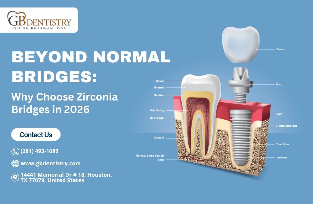 Zirconia Bridges - GB Dentistry