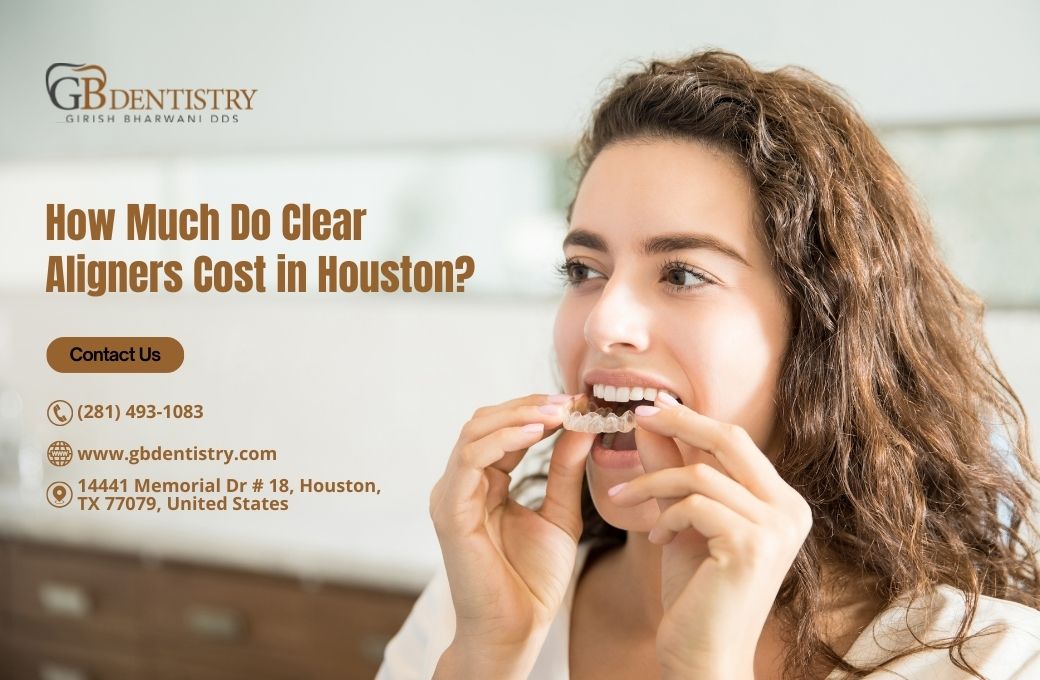 How Much Do Clear Aligners Cost in Houston?