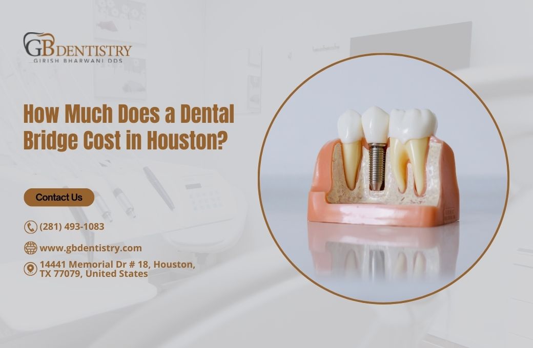How Much Does a Dental Bridge Cost in Houston