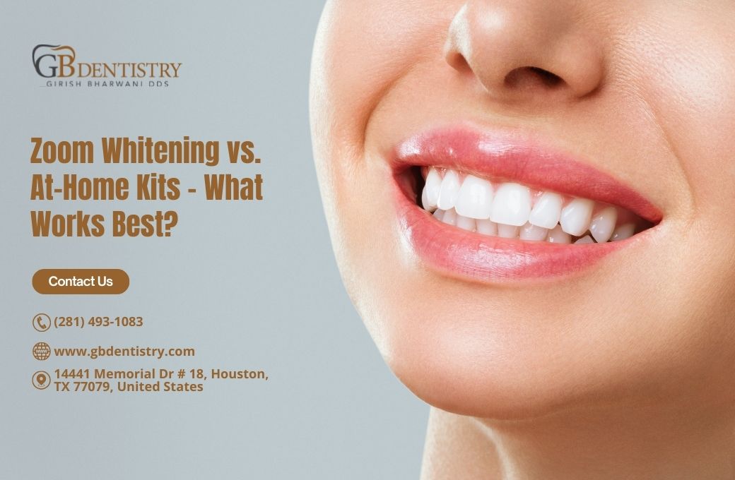 Zoom Whitening vs. At-Home Kits – What Works Best