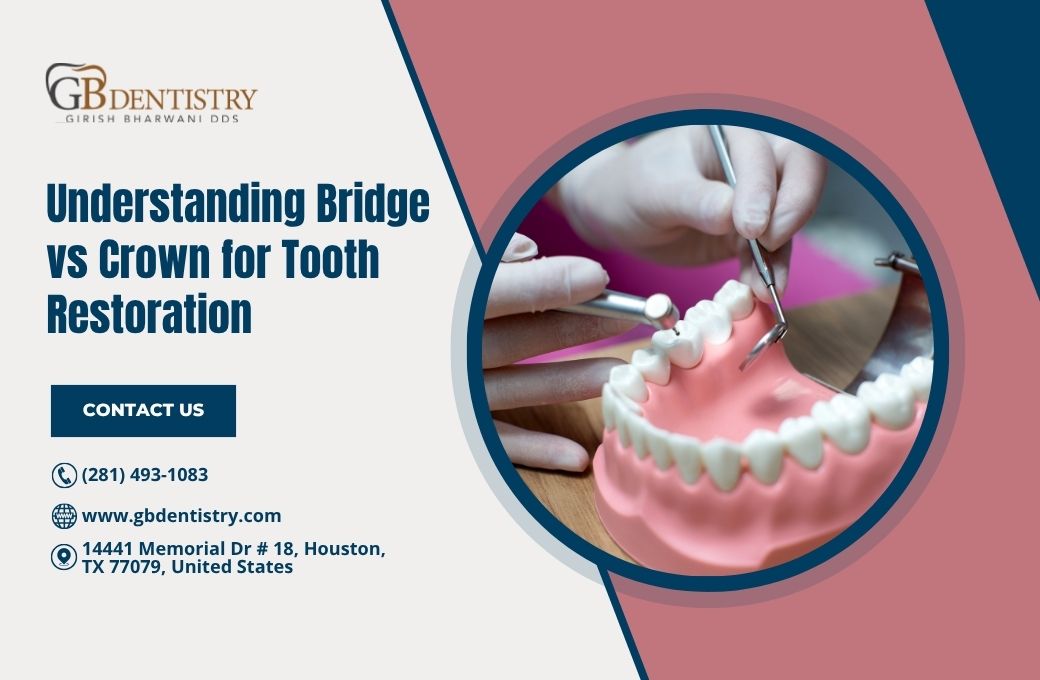 Understanding Bridge vs Crown for Tooth Restoration