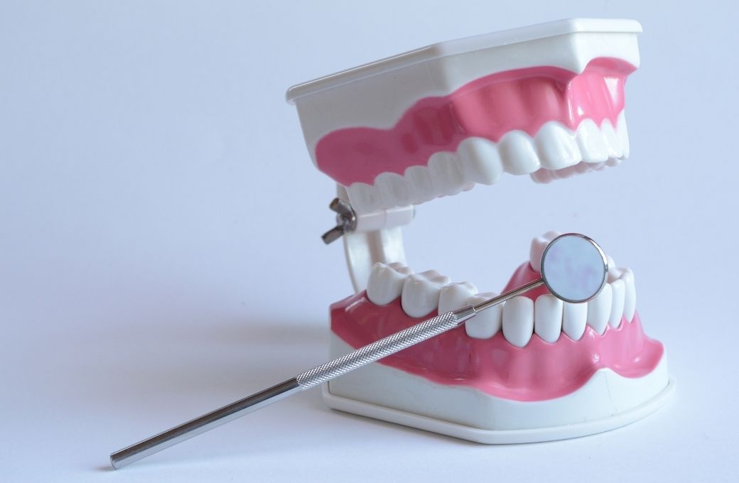 Dental Sealants - Adult Teeth
