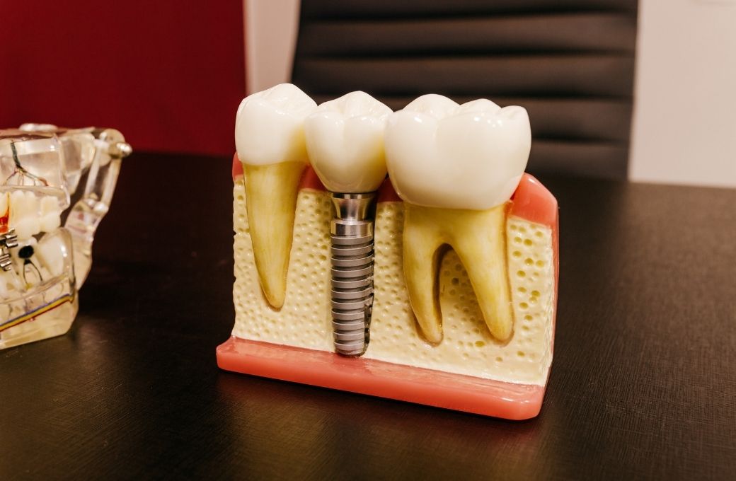 Durable and Natural - GB Dentistry