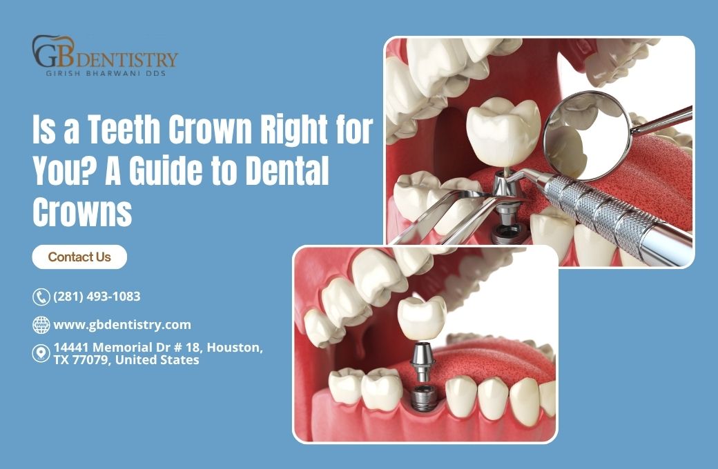 Is a Teeth Crown Right for You? A Guide to Dental Crowns