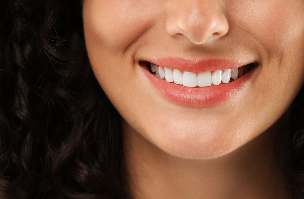 Traditional Porcelain Veneers - GB Dentistry