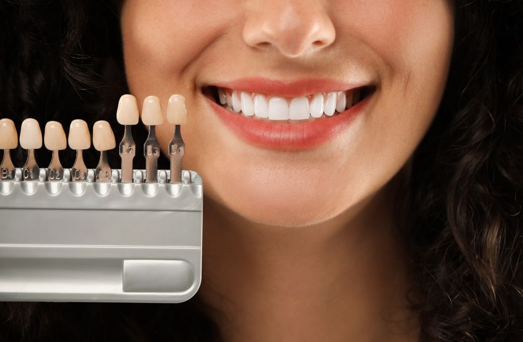 Transparent Crowns in Memorial - GB Dentistry