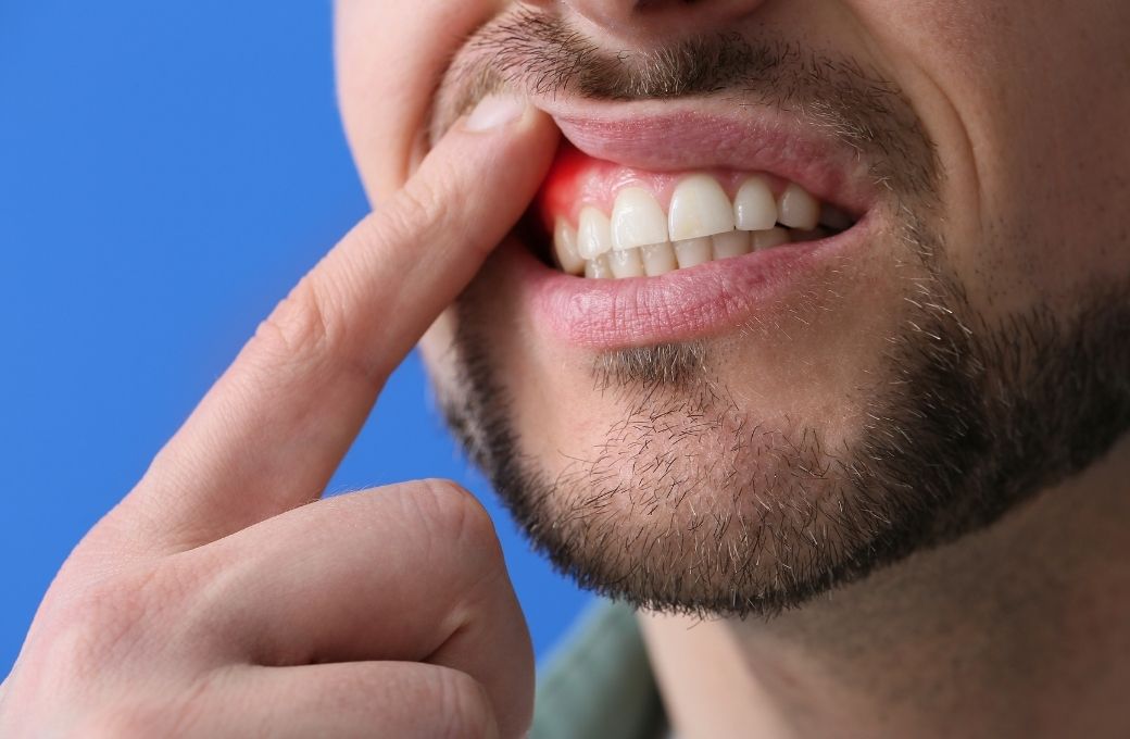 Gum Pain Relief Clinic - GB Dentistry