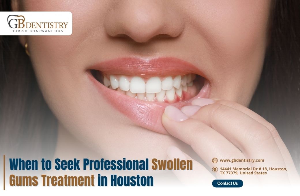 When to Seek Professional Swollen Gums Treatment in Houston