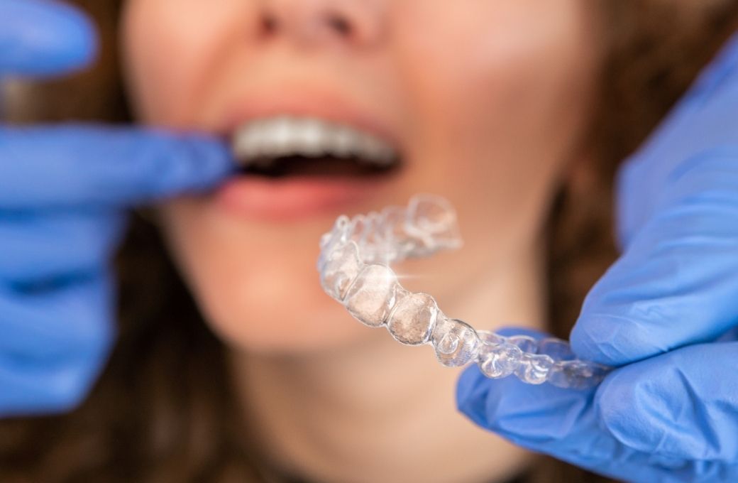 Transparent Braces Dentist - GB Dentistry
