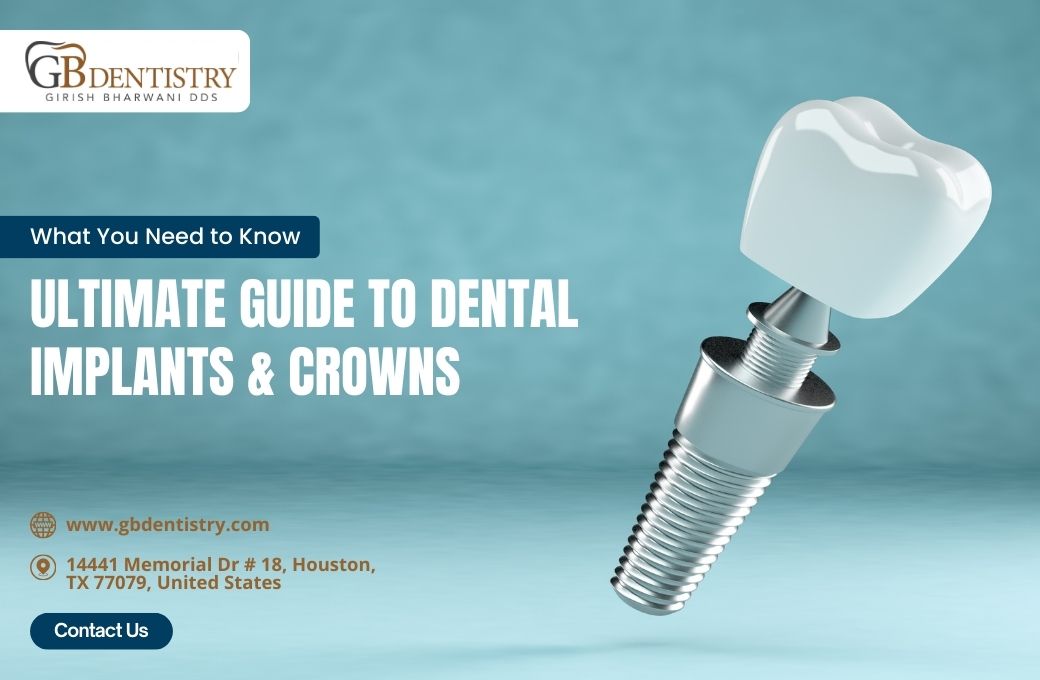 Ultimate Guide to Dental Implants Crowns: What You Need to Know