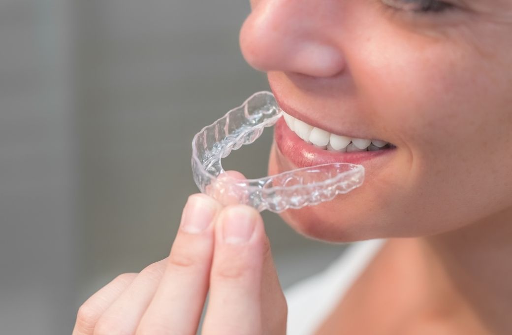 Invisible Braces Clinic - GB Dentistry