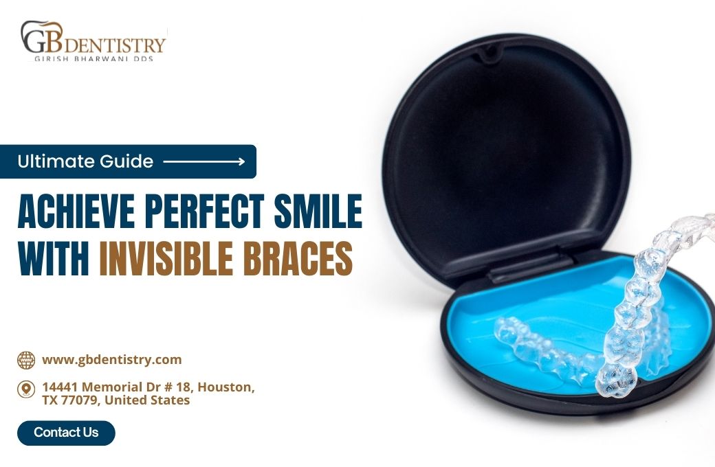 Achieve Perfect Smile with Invisible Braces: Ultimate Guide