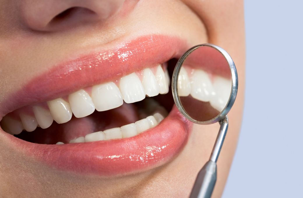 Teeth Caps Dentist - GB Dentistry