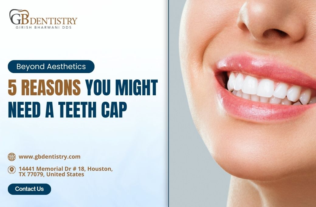Beyond Aesthetics: 5 Reasons You Might Need Teeth Caps