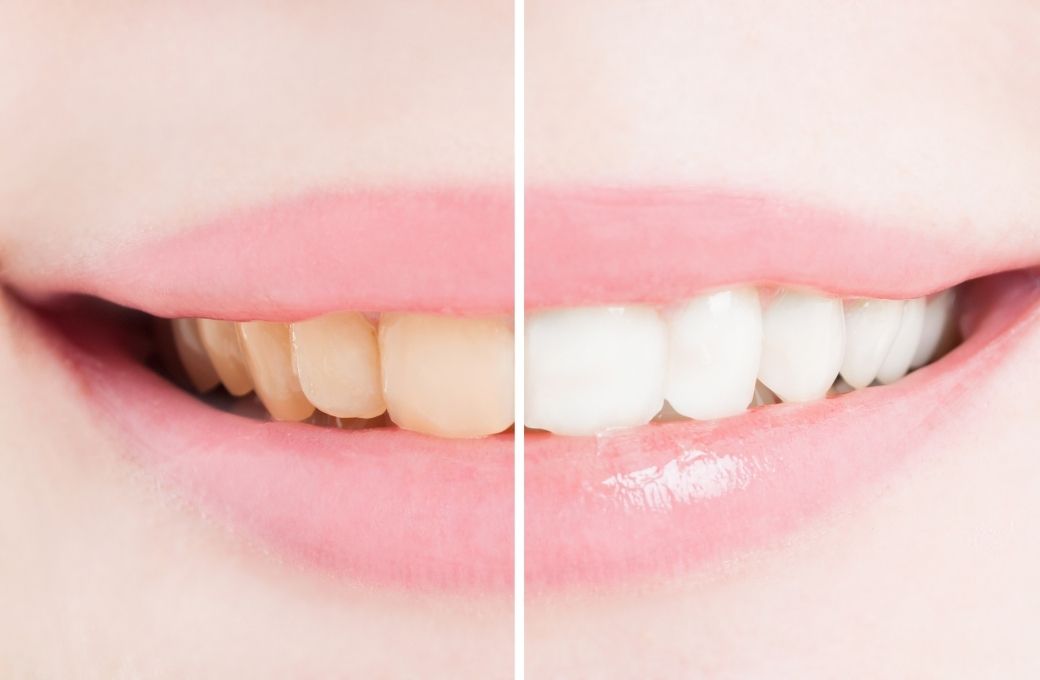 White Teeth Dentist - GB Dentistry