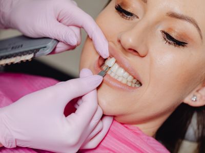15% OFF Select Services - GB Dentistry