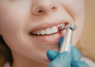 Dental Bonding Procedure - GB Dentistry Dental Bonding Procedure - GB Dentistry