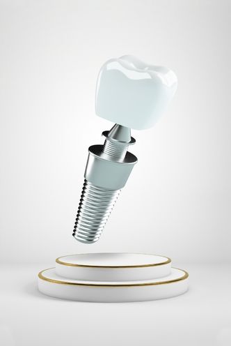Partial Dental Implants in Memorial - GB Dentistry