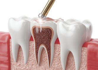 Root Canal Pain in Memorial - GB Dentistry Root Canal Pain in Memorial - GB Dentistry