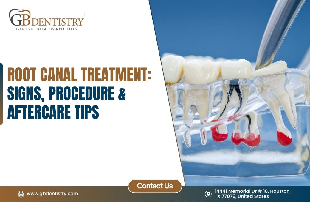 Root Canal Treatment: Signs, Procedure, and Aftercare Tips